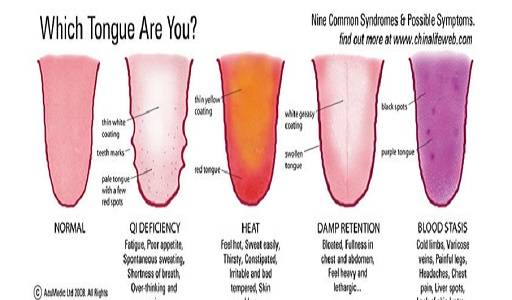 Tongue Health Chart: Understanding the Key Indicators of Oral Well-Being